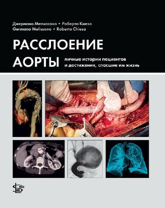 Расслоение аорты: личные истории пациентов и достижения, спасшие им жизнь. Мелиссано Дж. &quot;Логосфера&quot;. 2020