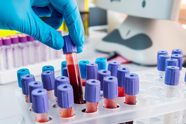 Лабораторные исследования