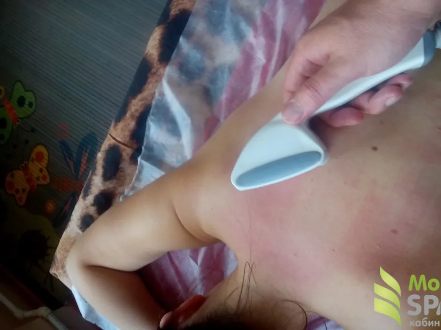 Проработка области спины аппаратом "Starvac".