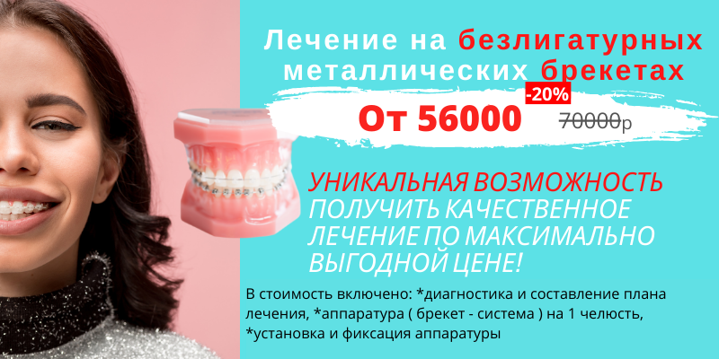 Лечение брекетами в Новосибирске, стоматология.