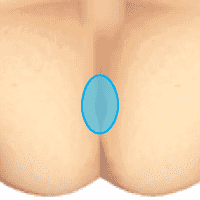 ДЭНАС при простатите. Область промежности