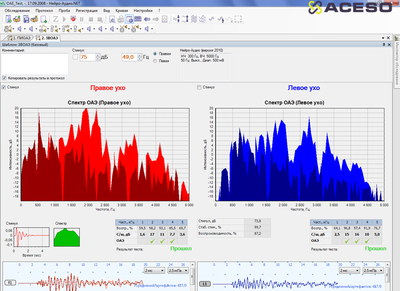 Нейро-Аудио/СВП 2-канальный прибор для проведения объективной аудиометрии (КСВП)