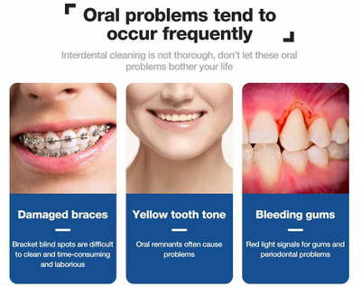 Электрический ирригатор Nicefeel FC188G