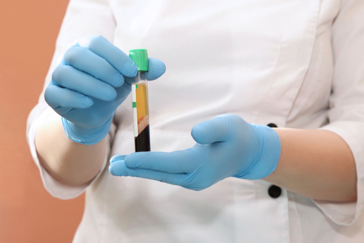 плазмолифтинг в Cicada Clinic