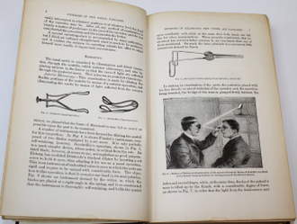 Bosworth F.H. A text-book of diseases of the nose and throat. Руководство по болезням горла и носа. London: Bailliere, Tindall and Cox, 1897.