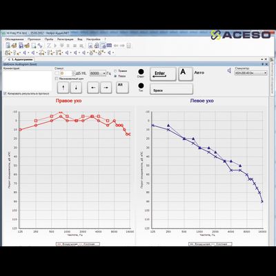 Нейро-Аудио 2-канальный прибор для проведения объективной аудиометрии КСВП, ОАЭ, VEMP, ASSR, ЭКохГ