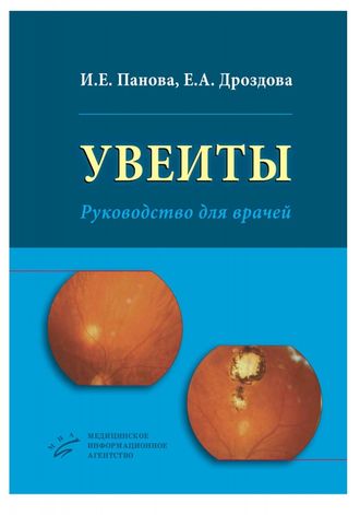 Увеиты: Руководство для врачей Панова И.Е., Дроздова Е.А. &quot;МИА&quot;. 2014