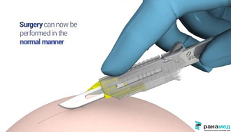 Лезвия Сванн-Мортон безопасные серия KLEEN №11 (нержавеющая сталь) 500шт.