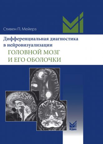 Дифференциальная диагностика в нейровизуализации. Головной мозг и его оболочки. Стивен П. Мейерз. МЕДпресс-информ&quot;. 2023