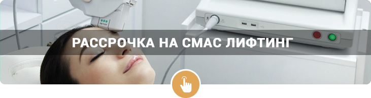 Рассрочка на смас лифтинг