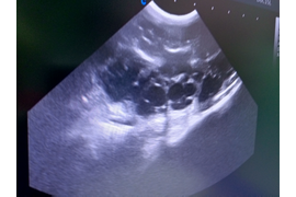 Ультразвуковая диагностика