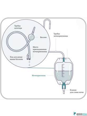 Катетер Фолея двухходовой, латексный Zhanjiang Star, Ch/Fr 12, объем баллона 30 мл (Китай)