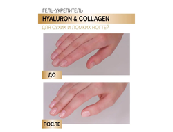 Гель-Укрепитель Hyaluron & Collagen для сухих и ломких ногтей 9г ЛЮКСВИЗАЖ
