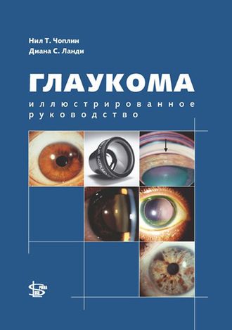 Глаукома. Иллюстрированное руководство. Нил Т. Чоплин. &quot;Логосфера&quot;. 2011