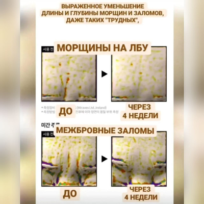 LABIOTTE Премиальные маски для тотального омоложения кожи 10шт.