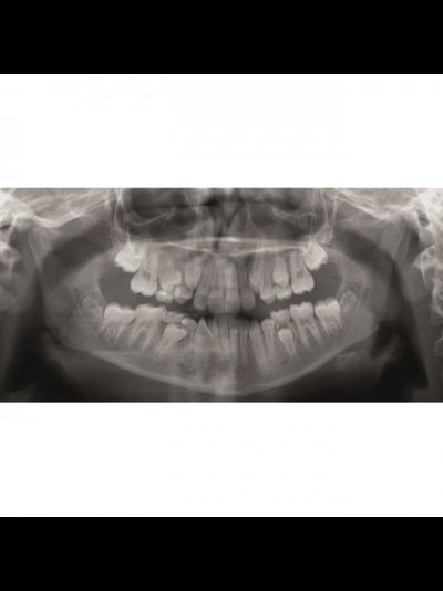 Gendex GXDP-300™ - Цифровая панорамная рентгенодиагностическая система | KAVO DENTAL (Германия)