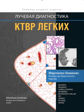 Лучевая диагностика. КТВР легких. С. Мартинес-Хименес, М. Л., Розадо-де-Кристенсон, Б. В. Картер. &quot;Издательство Панфилова&quot;. 2022