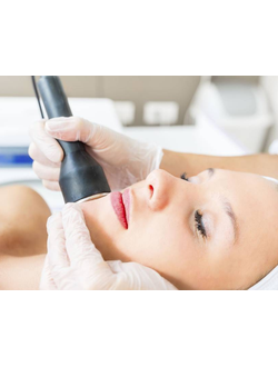 RF-лифтинг лица