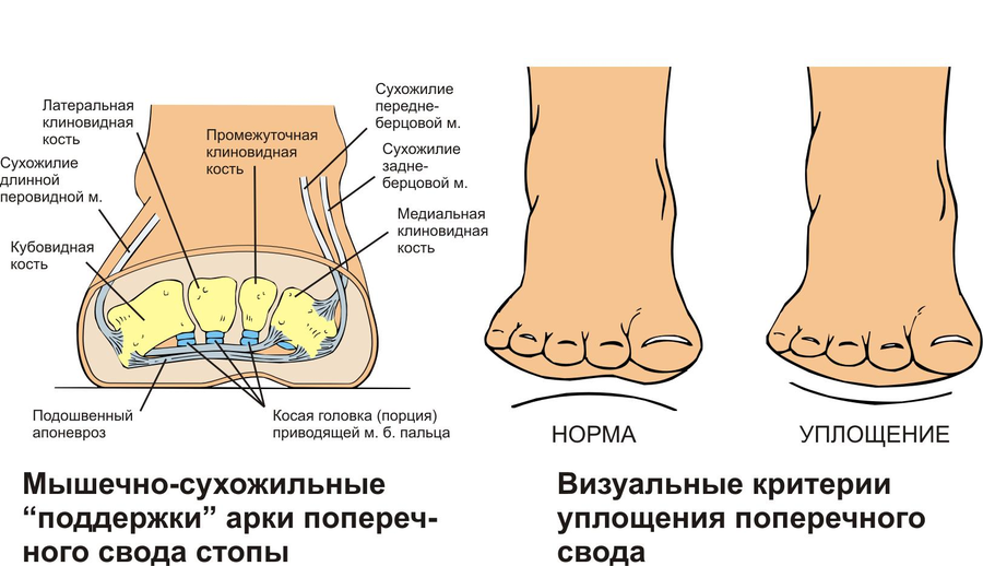 продольный свод стопы анатомия. продольный и поперечный свод стопы. внутренний и внешний свод стопы. поперечный свод стопы. продольный свод стопы анатомия.