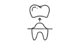 Протезирование зубов (коронки)