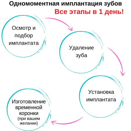 Одномоментная имплантация зубов отличие