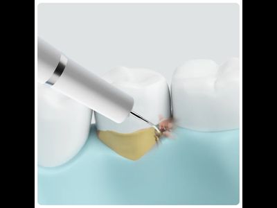 Ультразвуковой скалер Xiaomi Dr. Bei YC2 Ultrasonic Tooth Cleaner