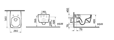 Комплект: подвесной безободковый унитаз VitrA Metropole Rim-Ex, с тонким сиденьем с микролифтом, инсталяцией и панелью управления, 9820B003-7201