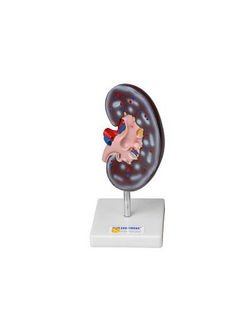 Модель почки в разрезе