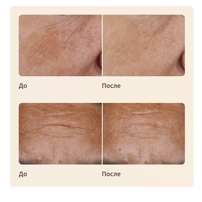 Artistry LongXevity™ Восстанавливающий тонер-сыворотка, 125мл