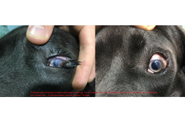 Глазная хирургия