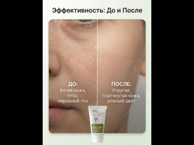 Крем ВИТАКОМПЛЕКС-АКТИВ, ЦВЕТОКОРРЕКТОР, 50 мл.