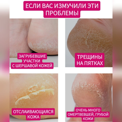 PETITFEE Маски с сухой эссенцией для смягчения кожи ног 5 пар