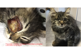 Глазная хирургия