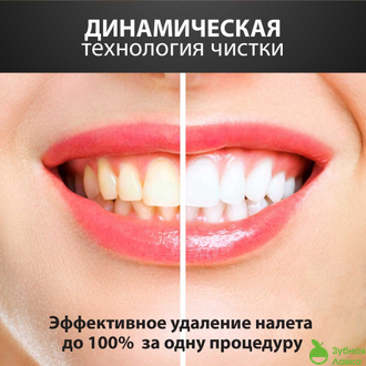 Звуковая щетка OMIO - ST102