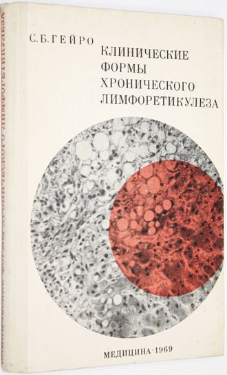 Гейро С.Б. Клинические формы хронического лимфоретикулеза. Л.: Медицина. 1969г.