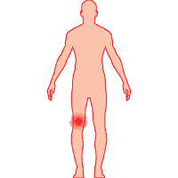 Зона пораженных суставов, мышц. ДЭНАС ПКМ [НЕЙРОДЭНС] 