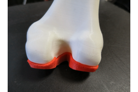 Шаблон коленного сустава