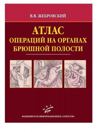 Атлас операций на органах брюшной полости. Жебровский В.В. &quot;МИА&quot;. 2009