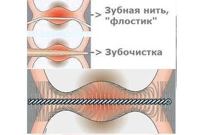 Межзубные ершики Dental Brush M, 0,6 мм, синие,  Plackers, 24 шт.