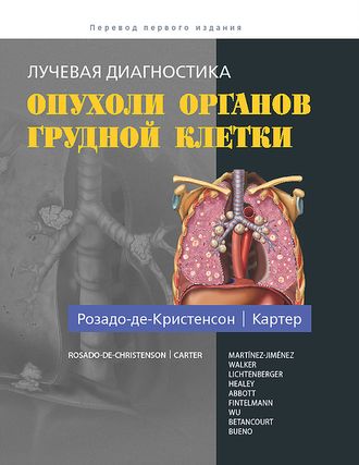 Лучевая диагностика. Опухоли органов грудной клетки. М.Л. Розадо-де-Кристенсон, Б.В. Картер и др. &quot;Издательство Панфилова&quot;. 2018