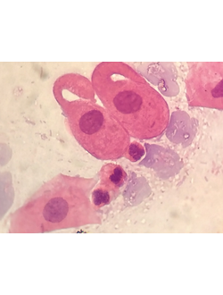 Клиническая цитология