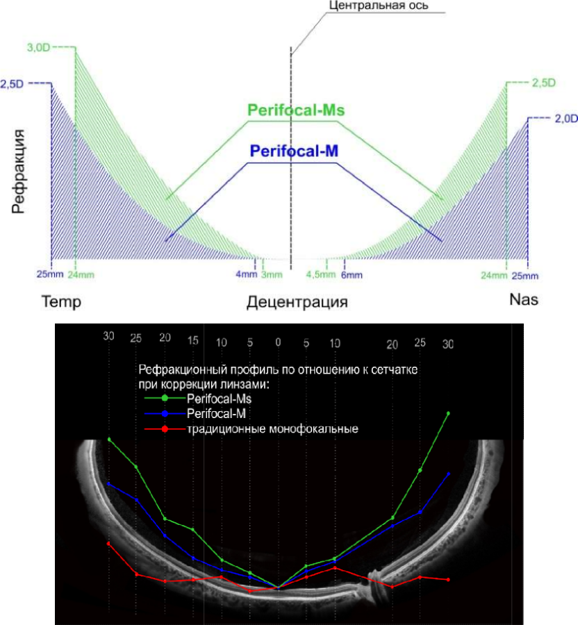 Без перифокальной реакции. Perifocal линзы покрытие. Линзы для очков перифокал. Perifocal линзы для очков. Перифокал Екатеринбург линзы.
