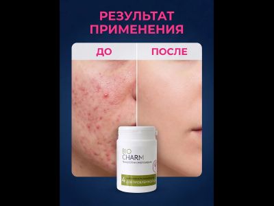 Маска № 4 ДЛЯ ПРОБЛЕМНОЙ КОЖИ от угревой сыпи, 50 гр.