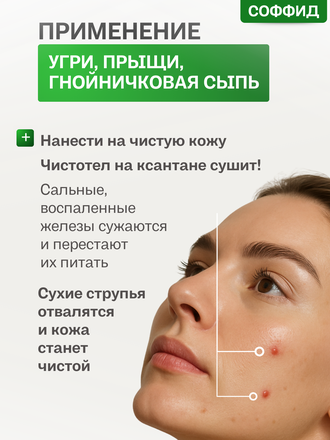 Экстракт чистотела на ксантановой камеди 100 гр.