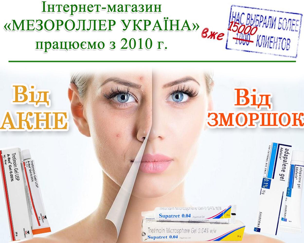 Differin-adapalene-ot-acne-ot-prischei