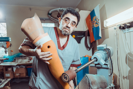 Протезирование нижних конечностей