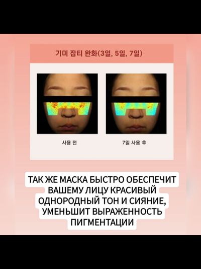REVCELL Маска - коллагеновый бандаж для интенсивного лифтинга 5шт.