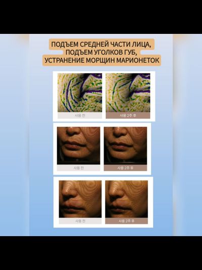 MARSHIQUE Маски для разглаживания и лифтинга зоны улыбки 3 пары