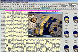 Видео ЭЭГ мониторинг  дневной 2 часа