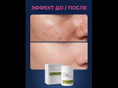 Маска № 3 СУЖЕНИЕ ПОР, ТОНУС для жирной кожи с расширенными порами, 50 гр.